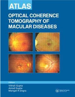 Cover of the book Atlas of Optical Coherence Tomography of Macular Diseases