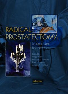 Couverture de l’ouvrage Radical Prostatectomy