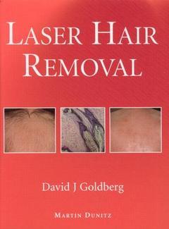 Couverture de l’ouvrage Laser hair removal
