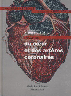 Couverture de l'ouvrage Imagerie du coeur et des artères coronaires
