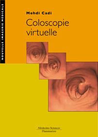 Couverture de l’ouvrage Coloscopie virtuelle