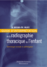Couverture de l’ouvrage Guide d'interprétation de la radiographie thoracique de l'enfant : séméiologie normale et pathologique