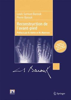Cover of the book Reconstruction de l'avant-pied