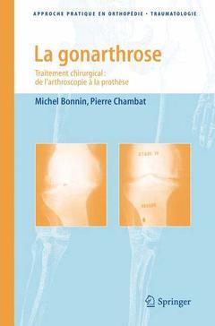 Cover of the book La gonarthrose