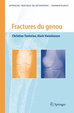 Cover of the book Fractures du genou
