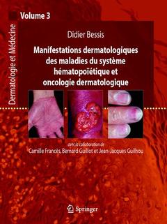Cover of the book Manifestations dermatologiques des maladies du système hématopoïétique et oncologie dermatologique