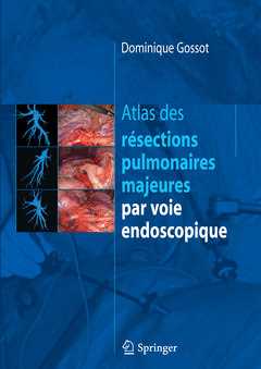 Couverture de l’ouvrage Atlas des résections pulmonaires majeures par voie endoscopique
