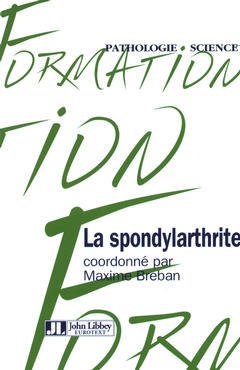 Cover of the book La spondylarthrite ankylosante