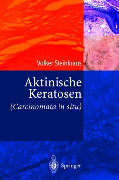Cover of the book Aktinische Keratosen (Carcinomata in situ)