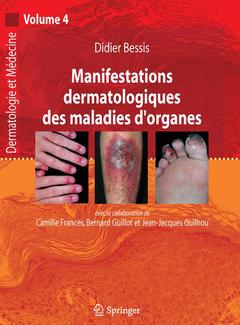Couverture de l’ouvrage Manifestations dermatologiques des maladies d'organes (Dermatologie et médecine, volume 4)
