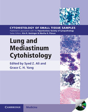 Cover of the book Lung and Mediastinum Cytohistology with CD-ROM