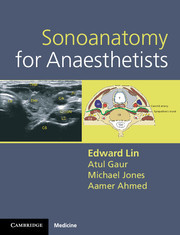 Cover of the book Sonoanatomy for Anaesthetists