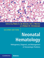 Couverture de l’ouvrage Neonatal Hematology