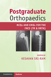 Cover of the book Postgraduate Orthopaedics