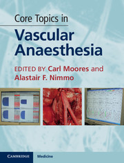 Couverture de l’ouvrage Core Topics in Vascular Anaesthesia