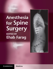 Couverture de l’ouvrage Anesthesia for Spine Surgery