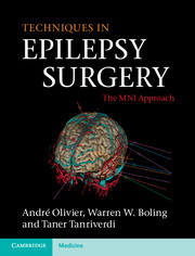 Cover of the book Techniques in Epilepsy Surgery
