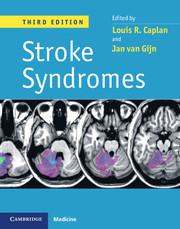 Couverture de l’ouvrage Stroke Syndromes, 3ed