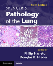 Cover of the book Spencer's pathology of the lung (6th Ed. )