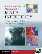 Cover of the book Surgical and Medical Management of Male Infertility