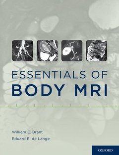 Couverture de l’ouvrage Essentials of Body MRI
