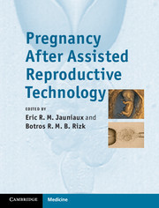 Couverture de l’ouvrage Pregnancy After Assisted Reproductive Technology