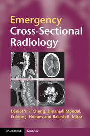 Cover of the book Emergency Cross-sectional Radiology