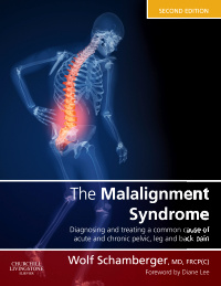 Couverture de l’ouvrage The Malalignment Syndrome