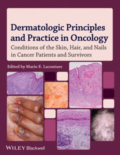 Couverture de l’ouvrage Dermatologic Principles and Practice in Oncology