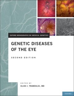 Couverture de l’ouvrage Genetic Diseases of the Eye