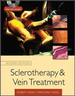 Cover of the book Sclerotherapy and vein treatment with DVD