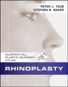 Couverture de l’ouvrage Rhinoplasty (with CD-ROM)
