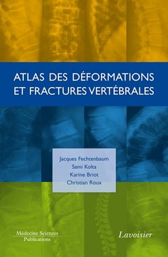 Cover of the book Atlas des déformations et fractures vertébrales