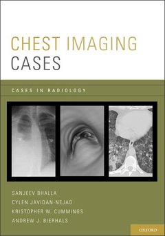 Couverture de l’ouvrage Chest Imaging Cases