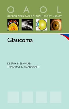 Couverture de l’ouvrage Glaucoma