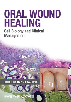 Couverture de l’ouvrage Oral Wound Healing