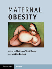 Couverture de l’ouvrage Maternal Obesity