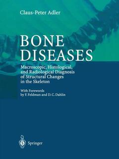 Couverture de l’ouvrage Bone Diseases