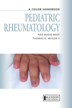 Couverture de l’ouvrage Pediatric Rheumatology