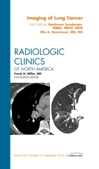 Couverture de l’ouvrage Imaging of Lung Cancer, An Issue of Radiologic Clinics of North America