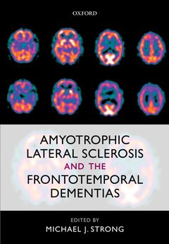Couverture de l’ouvrage Amyotrophic Lateral Sclerosis and the Frontotemporal Dementias