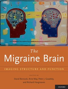 Cover of the book The Migraine Brain