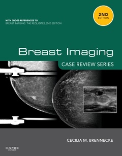 Couverture de l’ouvrage Breast Imaging: Case Review Series