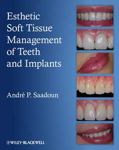Couverture de l’ouvrage Esthetic Soft Tissue Management of Teeth and Implants