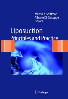 Cover of the book Liposuction
