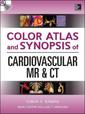 Couverture de l'ouvrage Color Atlas and Synopsis of Cardiovascular MR and CT with DVD