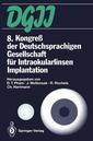Couverture de l'ouvrage 8. Kongreß der Deutschsprachigen Gesellschaft für Intraokularlinsen Implantation