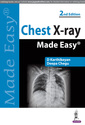 Couverture de l'ouvrage Chest X-ray Made Easy
