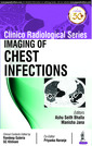 Couverture de l'ouvrage Clinico Radiological Series: Imaging of Chest Infections