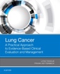 Couverture de l'ouvrage Lung Cancer: A Practical Approach to Evidence-Based Clinical Evaluation and Management